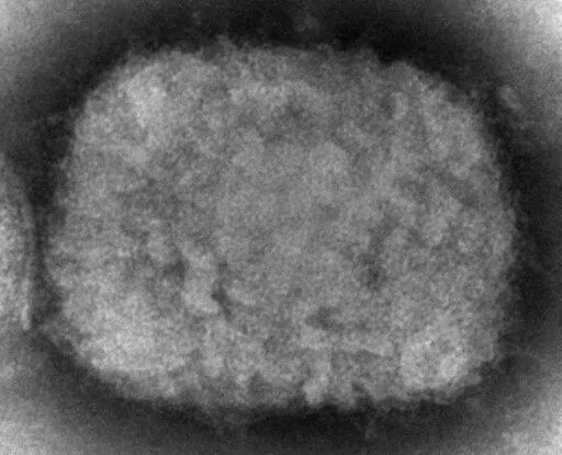 This 2003 electron microscope image made available by the U.S. Centers for Disease Control and Prevention shows a monkeypox virion, obtained from a sample associated with the 2003 prairie dog outbreak. Two children have been diagnosed with monkeypox in the United States: a toddler in California and an infant who is not a U.S. resident, health officials said Friday, July 22, 2022. (Cynthia S. Goldsmith, Russell Regner/CDC via AP, File)