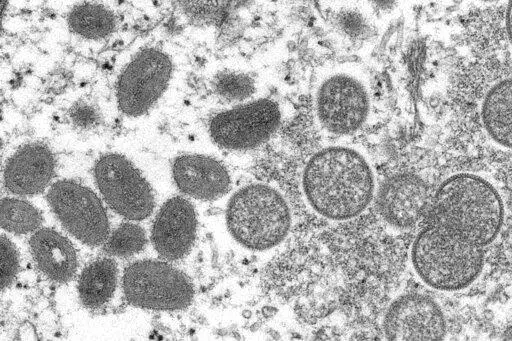 This 2003 electron microscope image made available by the Centers for Disease Control and Prevention shows mature, oval-shaped monkeypox virions, left, and spherical immature virions, right, obtained from a sample of human skin associated with the 2003 prairie dog outbreak. The World Health Organization will convene an emergency committee of experts to determine if the expanding monkeypox outbreak that has mysteriously spread outside its usual zones should be considered an international public h
